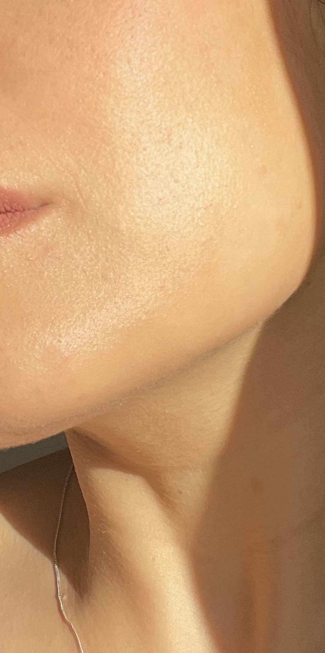 بوتاکس، اسکین بوسترها، مزو زیر چشم