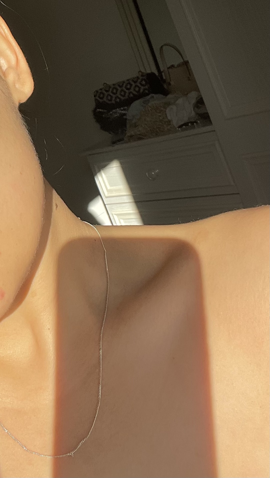 بوتاکس، اسکین بوسترها، مزو زیر چشم